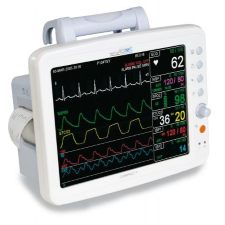 Monitoring